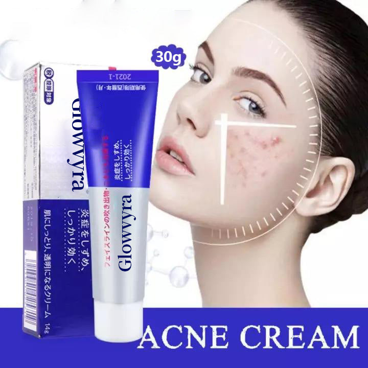 Japanese Acne Care Cream – Gentle Spot Treatment for Clearer Looking Skin