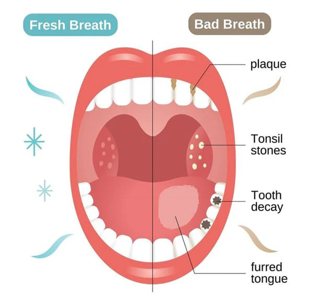 ✨ Instant Whitening Toothpaste – Brighter Smile, Fresher Breath ✨